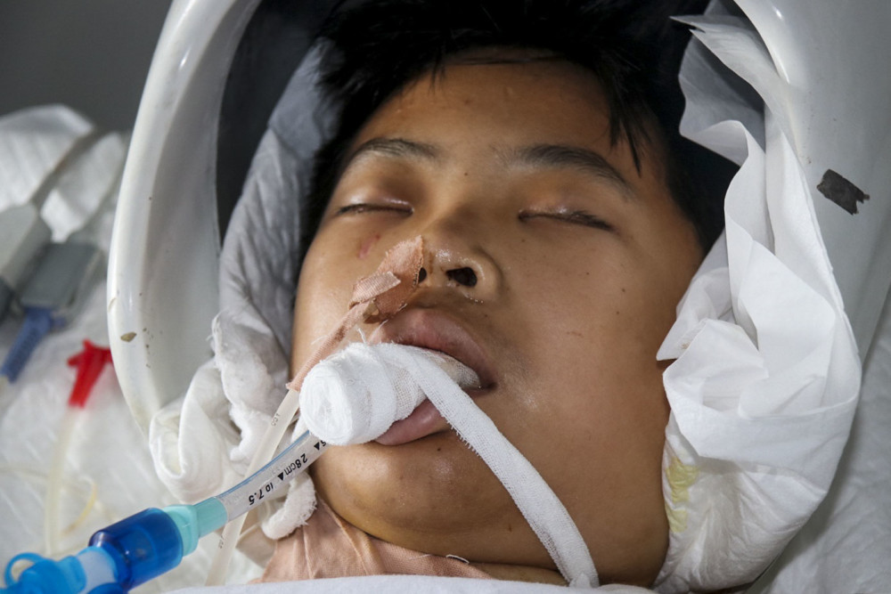 男孩昏迷背后的故事