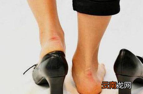 女生穿鞋磨脚后跟怎么处理
