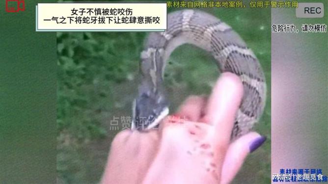 被蛇咬了多年后复发，深度解析与应对之道